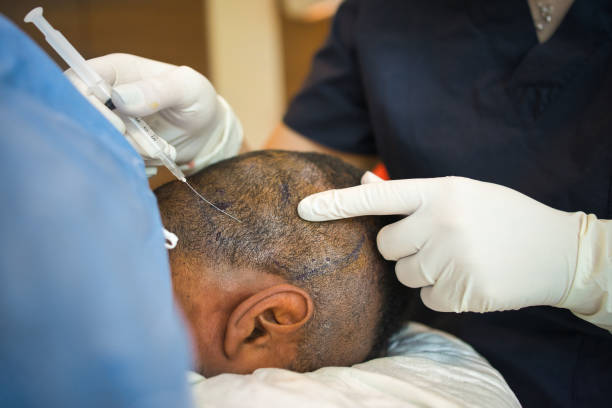Why You Should Get a Hair Transplant in Dubai